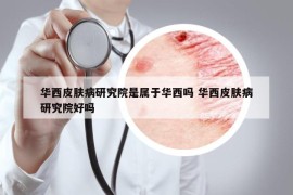 华西皮肤病研究院是属于华西吗 华西皮肤病研究院好吗