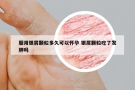 服用银屑颗粒多久可以怀孕 银屑颗粒吃了发胖吗