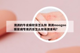 澳洲的牛皮癣软膏怎么样 澳洲moogoo银屑病专用药膏怎么样有激素吗?