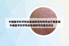 中国医学科学院皮肤病研究所如何治疗银屑病 中国医学科学院皮肤病研究所医生排名