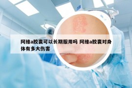 阿维a胶囊可以长期服用吗 阿维a胶囊对身体有多大伤害