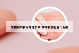 生物制剂有治疗什么病 生物制剂能治什么病