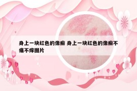 身上一块红色的像癣 身上一块红色的像癣不痛不痒图片