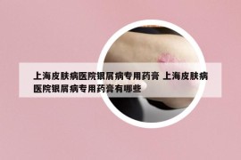 上海皮肤病医院银屑病专用药膏 上海皮肤病医院银屑病专用药膏有哪些