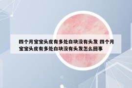 四个月宝宝头皮有多处白块没有头发 四个月宝宝头皮有多处白块没有头发怎么回事