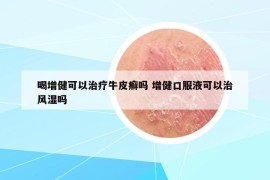 喝增健可以治疗牛皮癣吗 增健口服液可以治风湿吗