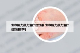 生命极光激光治疗仪效果 生命极光激光治疗仪效果好吗