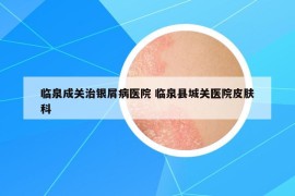 临泉成关治银屑病医院 临泉县城关医院皮肤科