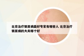 北京治疗银屑病最好专家有哪些人 北京治疗银屑病的大夫哪个好