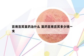 百用百灵苗药治什么 苗药百用百灵多少钱一支