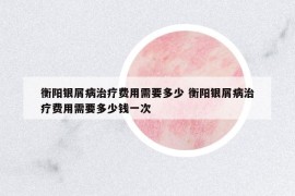 衡阳银屑病治疗费用需要多少 衡阳银屑病治疗费用需要多少钱一次