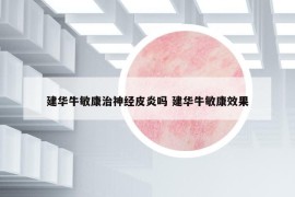 建华牛敏康治神经皮炎吗 建华牛敏康效果