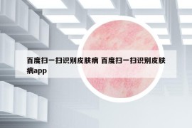 百度扫一扫识别皮肤病 百度扫一扫识别皮肤病app