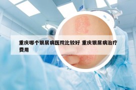 重庆哪个银屑病医院比较好 重庆银屑病治疗费用