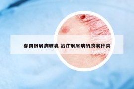 春雨银屑病胶囊 治疗银屑病的胶囊种类