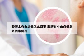 胳膊上有白点是怎么回事 胳膊有小白点是怎么回事图片