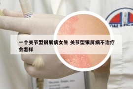 一个关节型银屑病女生 关节型银屑病不治疗会怎样