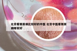 北京看银屑病比较好的中医 北京中医看银屑病哪家好