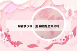癣霸多少钱一盒 癣霸是激素药吗
