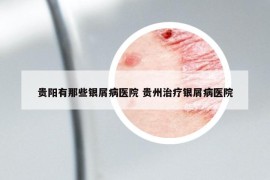 贵阳有那些银屑病医院 贵州治疗银屑病医院
