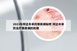 2023年阿达木单抗银屑病贴吧 阿达木单抗治疗银屑病的机理