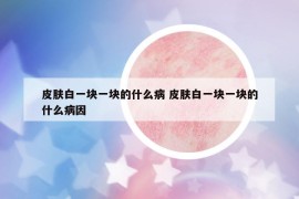 皮肤白一块一块的什么病 皮肤白一块一块的什么病因
