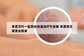 青蒿艾叶一起熬水洗澡治疗牛皮癣 青蒿和艾草煮水擦身