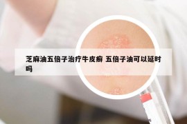 芝麻油五倍子治疗牛皮癣 五倍子油可以延时吗
