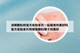 消银颗粒和复方氨肽素片一起服用效果好吗 复方氨肽素片和银屑颗粒哪个效果好