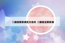禤国维银屑病处方血热 禤国维治银屑病