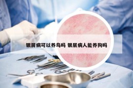 银屑病可以养鸟吗 银屑病人能养狗吗