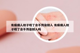 有癣病人蚊子咬了会不传染别人 有癣病人蚊子咬了会不传染别人吗