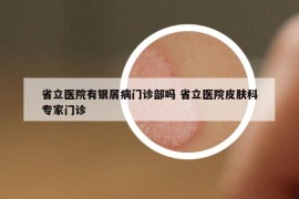 省立医院有银屑病门诊部吗 省立医院皮肤科专家门诊