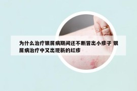 为什么治疗银屑病期间还不断冒出小疹子 银屑病治疗中又出现新的红疹