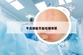 牛皮癣能不能吃裙带菜
