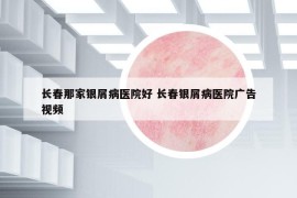 长春那家银屑病医院好 长春银屑病医院广告视频
