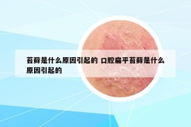 苔藓是什么原因引起的 口腔扁平苔藓是什么原因引起的