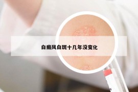 白癜风白斑十几年没变化