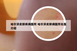 哈尔滨皮肤疾病医院 哈尔滨皮肤病医院名医介绍