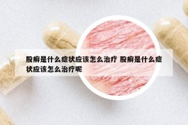 股癣是什么症状应该怎么治疗 股癣是什么症状应该怎么治疗呢