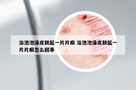浴池泡澡皮肤起一片片癣 浴池泡澡皮肤起一片片癣怎么回事