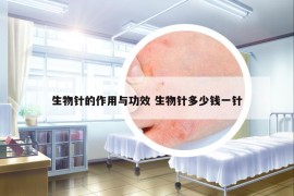 生物针的作用与功效 生物针多少钱一针