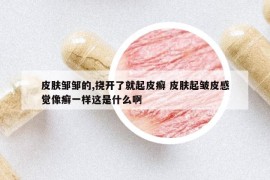 皮肤邹邹的,挠开了就起皮癣 皮肤起皱皮感觉像癣一样这是什么啊
