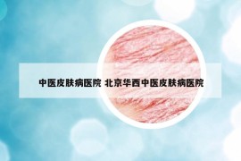 中医皮肤病医院 北京华西中医皮肤病医院
