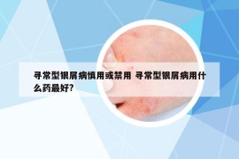 寻常型银屑病慎用或禁用 寻常型银屑病用什么药最好?