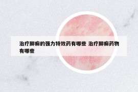 治疗脚癣的强力特效药有哪些 治疗脚癣药物有哪些