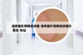 湿疹图片初期症状图 湿疹图片初期症状图片 男性 特征