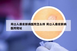 周口人康皮肤病医院怎么样 周口人康皮肤病医院地址