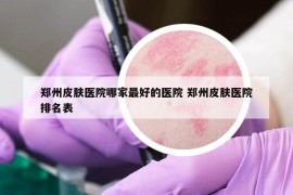 郑州皮肤医院哪家最好的医院 郑州皮肤医院排名表