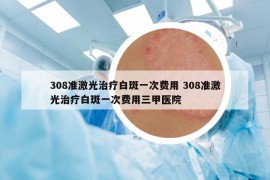 308准激光治疗白斑一次费用 308准激光治疗白斑一次费用三甲医院